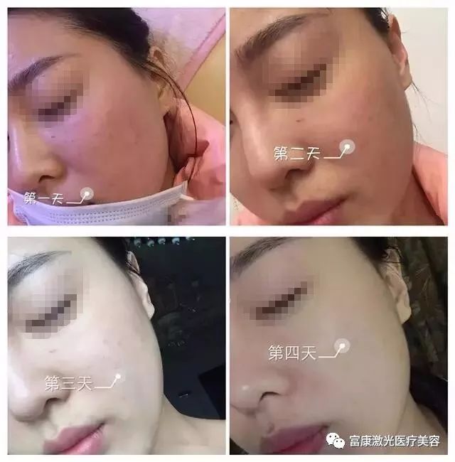 重塑青春魅力