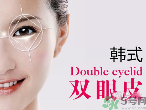 韩式双眼皮，美丽之选，值得考虑