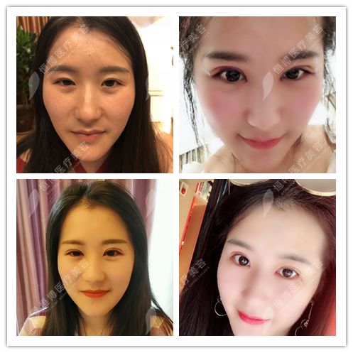 探索美丽新领域